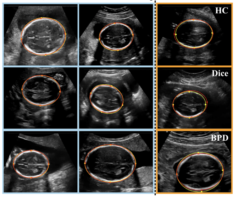 Human-level Performance On Automatic Head Biometrics In Fetal Ultrasound Using Fully Convolutional Neural Networks